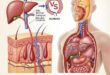 Jaundice Treatment in Adults
